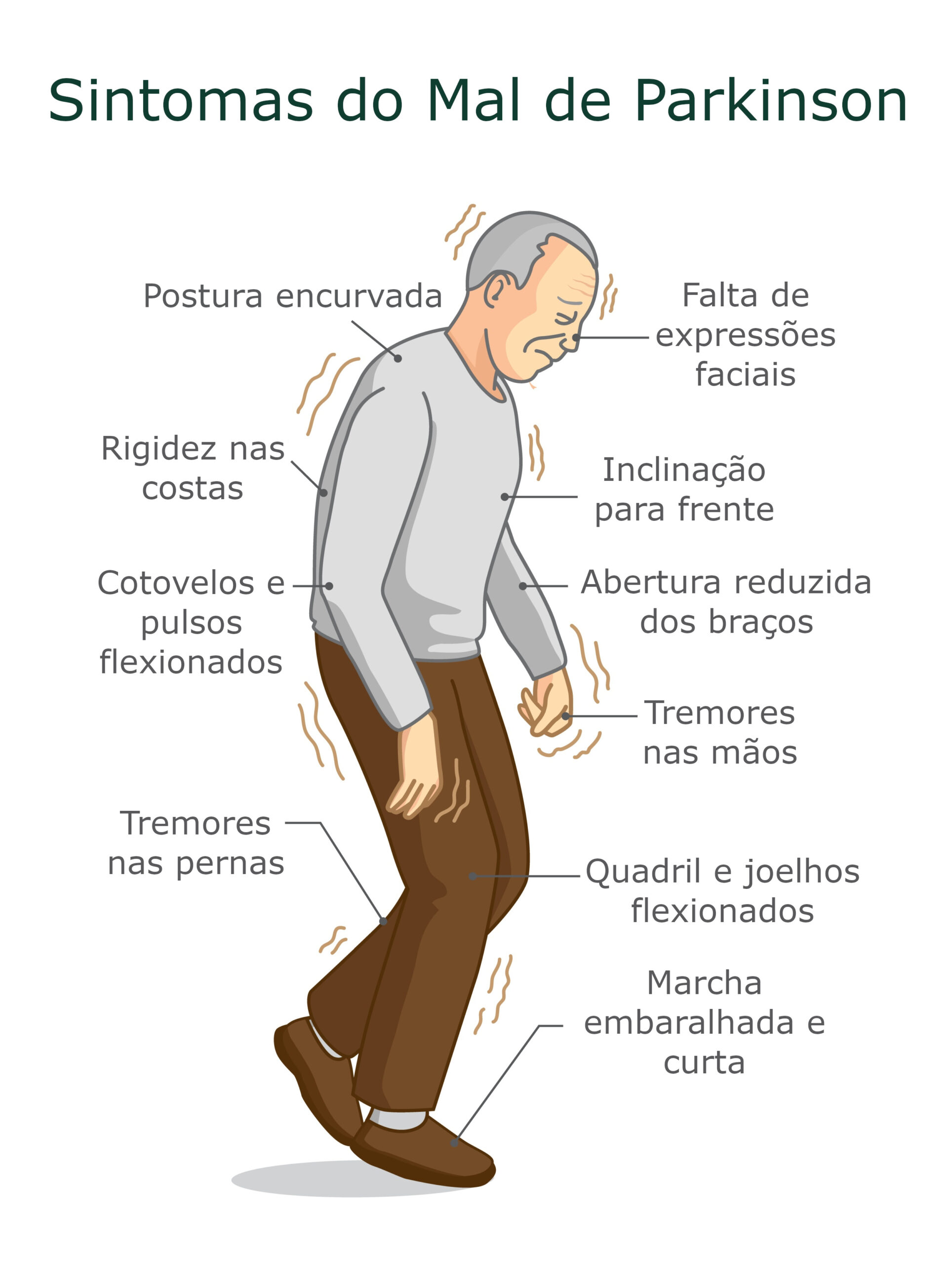 Mais de 200 mil brasileiros têm Doença de Parkinson, uma das que mais aumenta no mundo